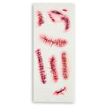 Tattoos Agrafes Et Points De Suture